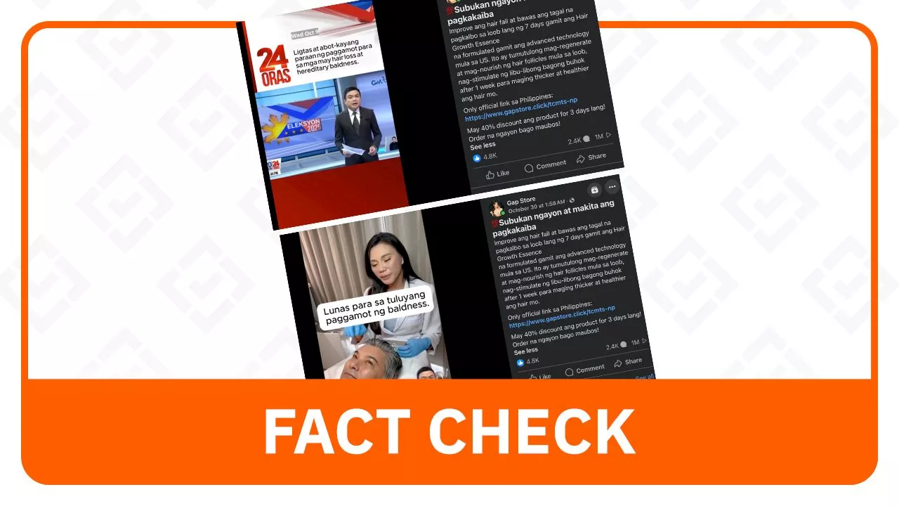 FACT CHECK: Ad for baldness ‘cure’ used face manipulation, AI-generated audio