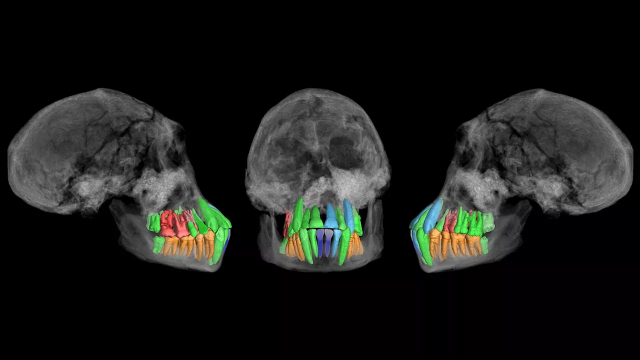 Fossil teeth hint at a surprisingly early start to humans’ long childhoods