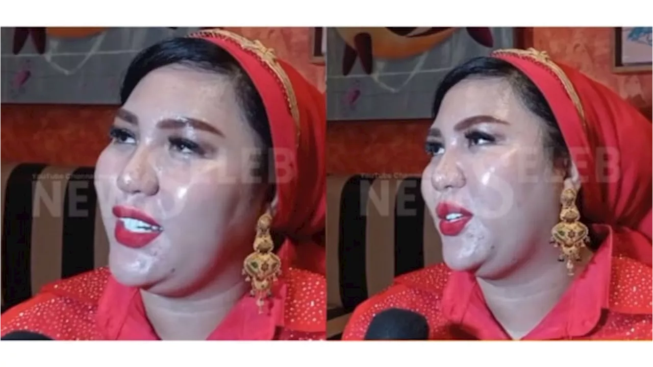 Mira Hayati Bos Skincare yang Terancam 15 Tahun Penjara Punya Harta Fantastis, Puluhan Miliar per Bulan!