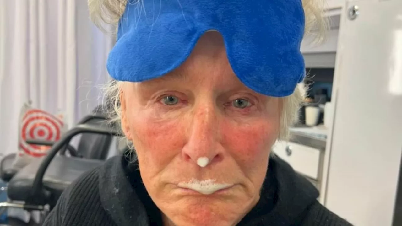 Major Hollywood star, 77, looks unrecognisable as she shares a morning selfie with an eye infection...