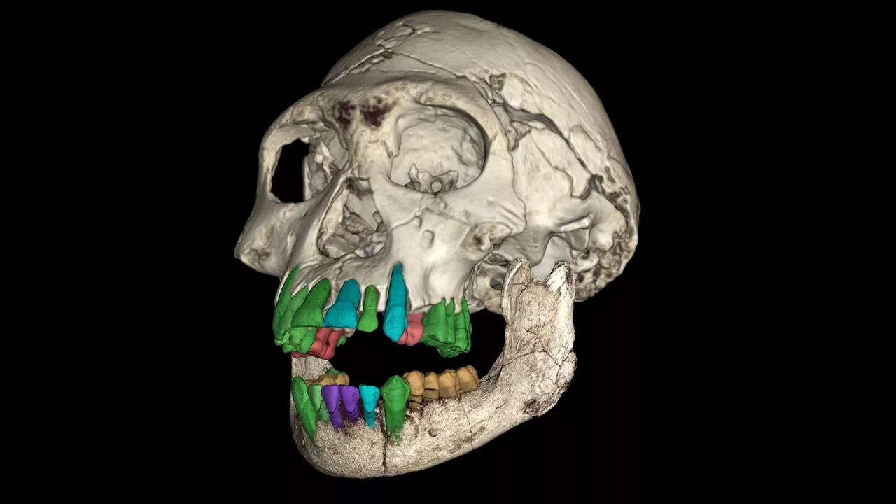 1.77 million-year-old human teeth link long childhoods to larger brains