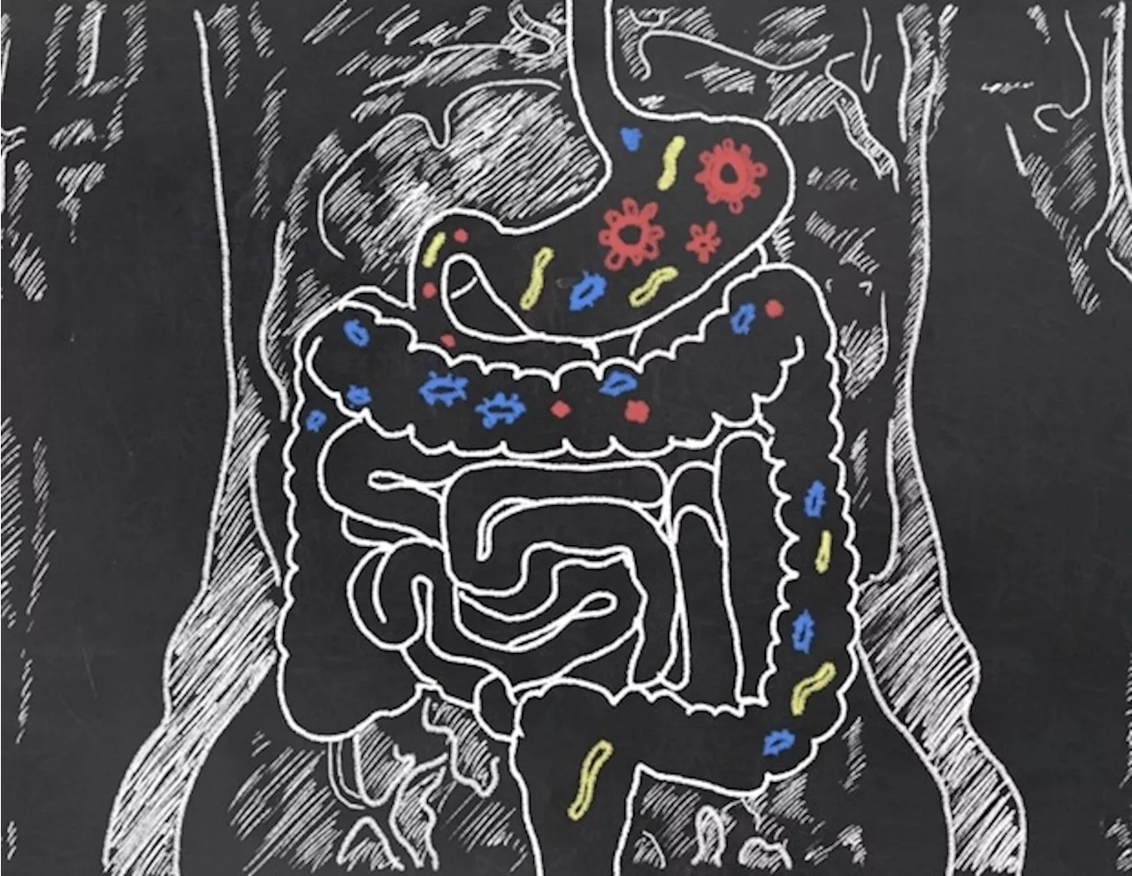 Study shows how microbial load affects gut health and disease