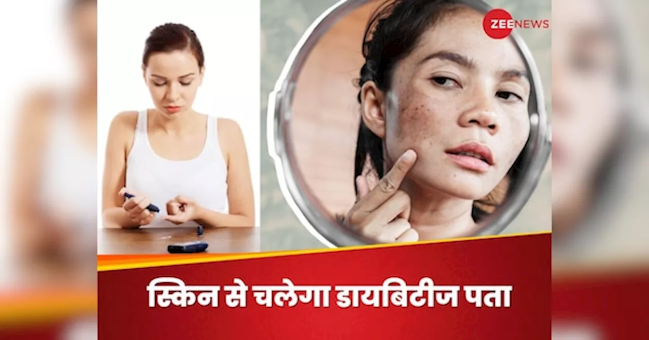 आपकी स्किन में दिखें ये 6 साइलेंट साइन, मान लीजिए पक्का हो गई डायबिटीज