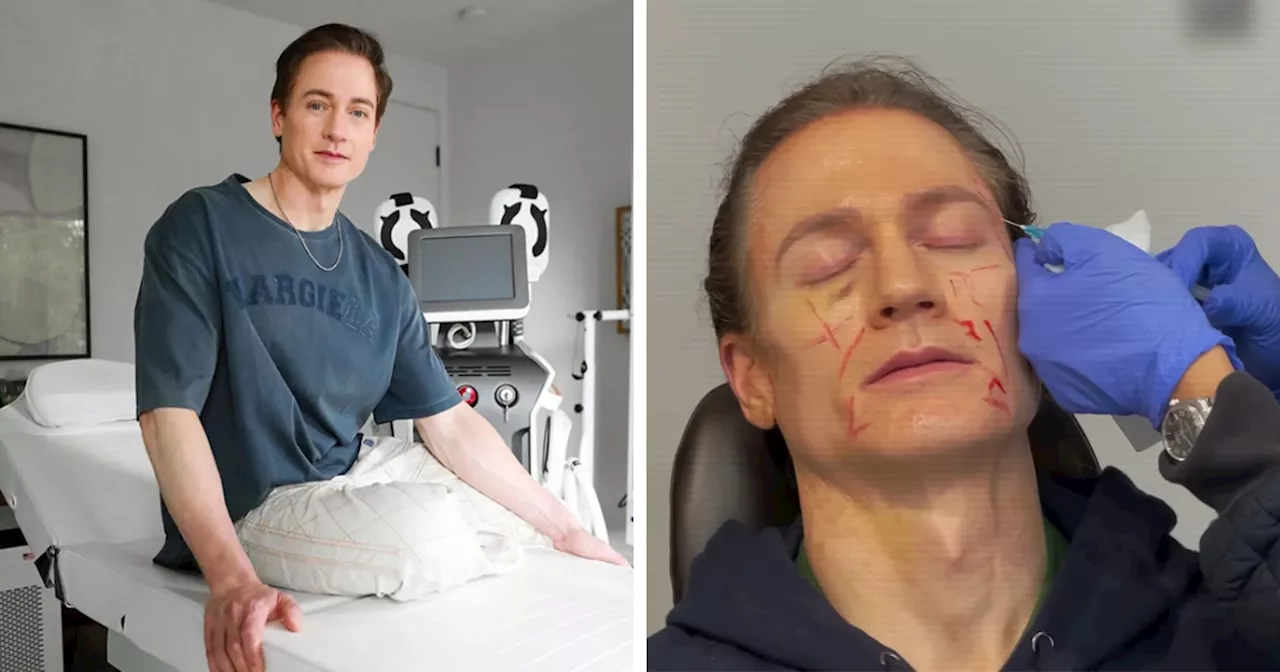 Billionaire Trying To Reverse Aging Injected Fat Into His Face—Reveals 'Disturbing' Results