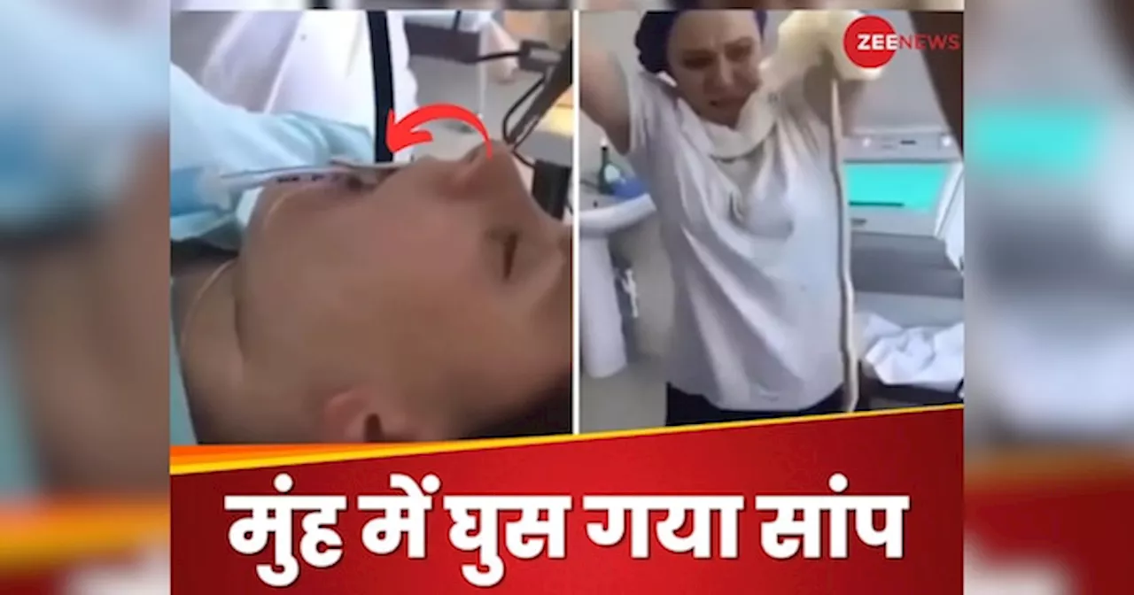 Video: सोते वक्त मुंह के अंदर घुस गया 4 फीट लंबा सांप, डॉक्टर ने निकालने के लिए किया ऐसा काम