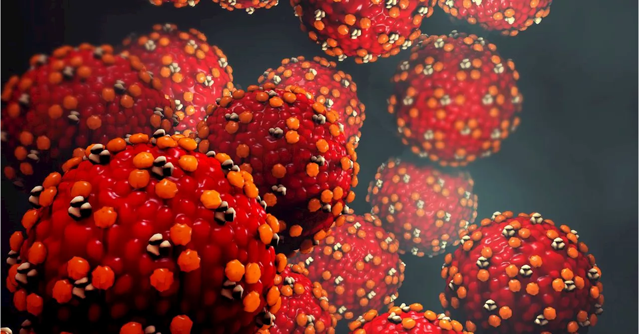 Measles alert issued after infectious case visits servo, brewery and medical centre in Sydney