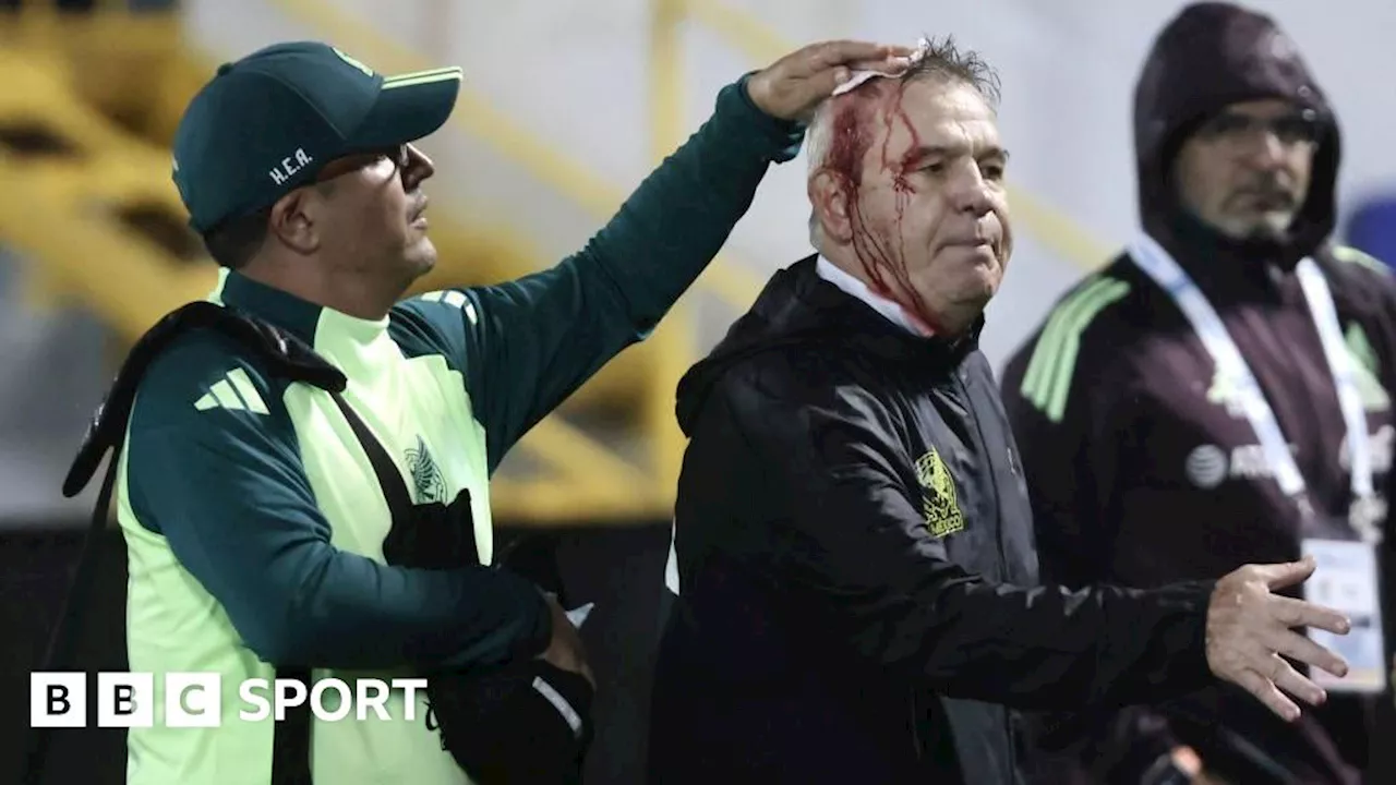 Mexico coach Javier Aguirre left bloodied after being hit with beer can after Honduras defeat