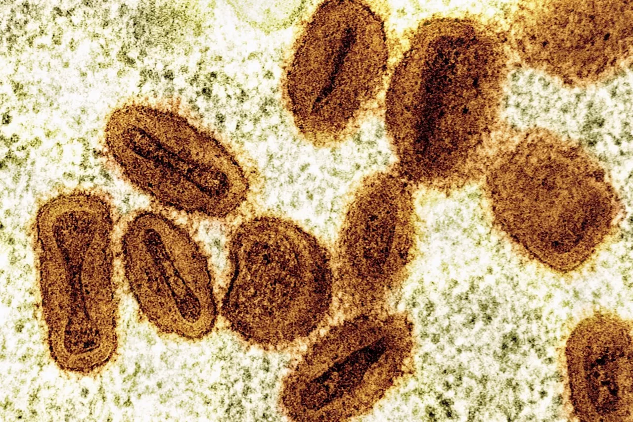 U.S. health officials report first case of new form of mpox in a traveler