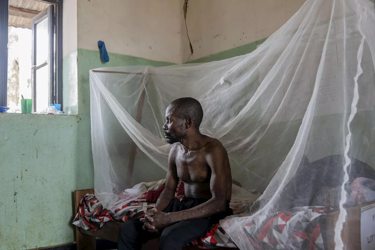 À Kinshasa, la progression du Mpox hors de contrôle