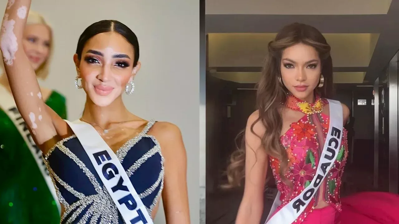 Miss Egipto tiene vitiligo y Miss Ecuador usa peluca: datos curiosos de Miss Universo 2024