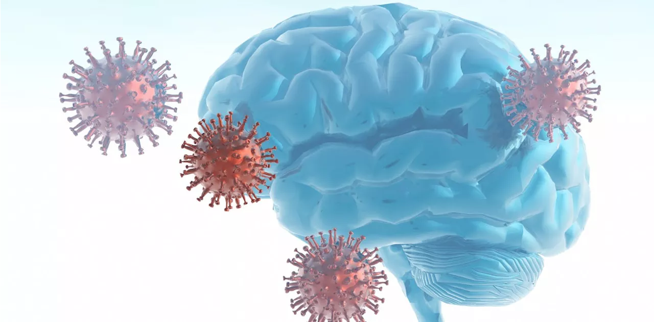 Mounting research shows that COVID-19 leaves its mark on the brain, including significant drops in IQ scores