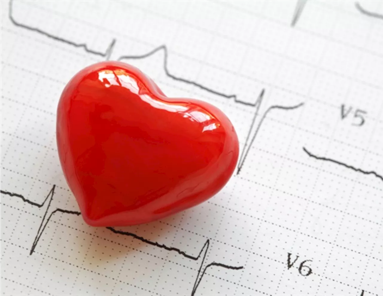 Proactively screening diabetes patients for heart disease does not improve long-term survival