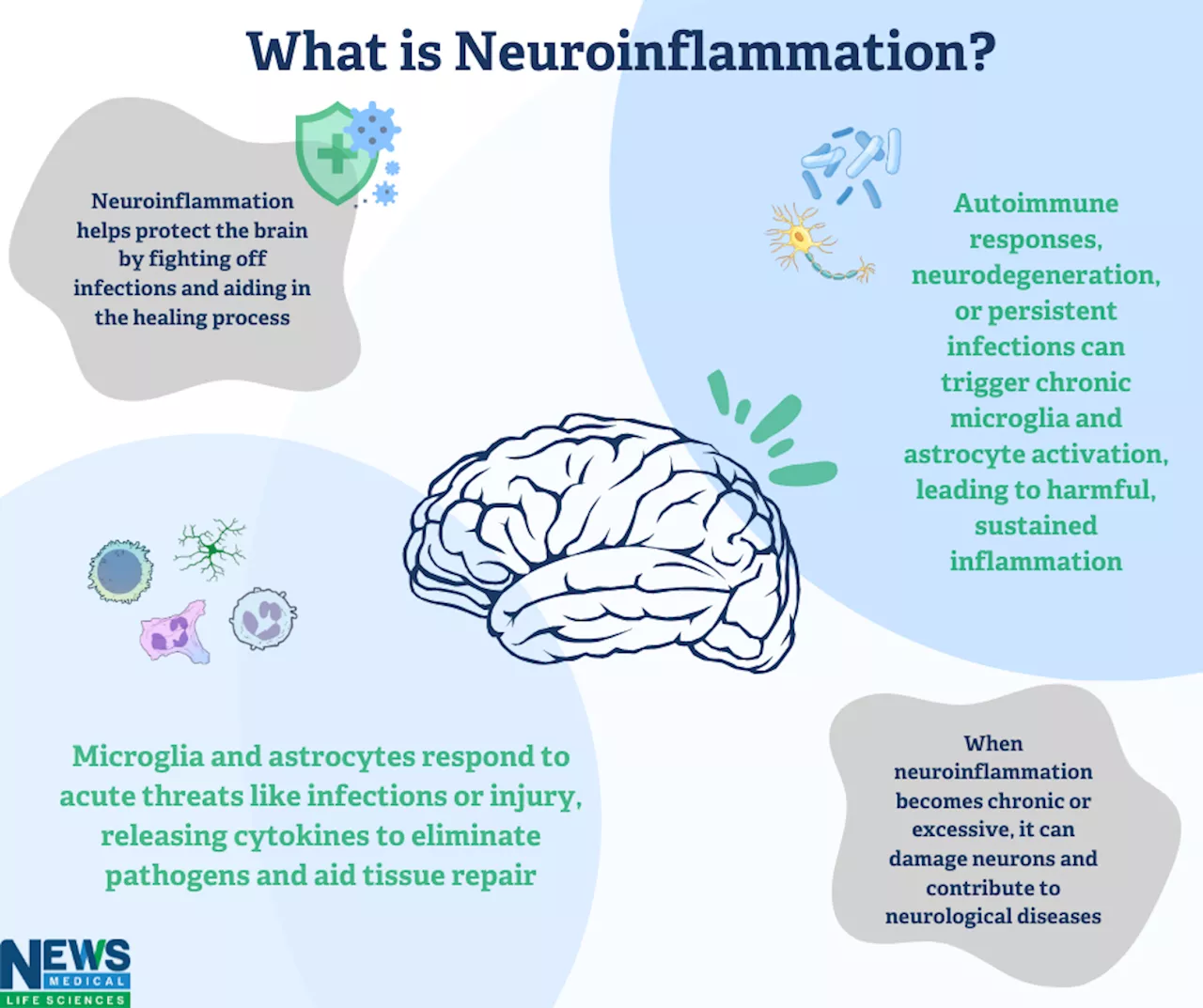 What is Neuroinflammation?