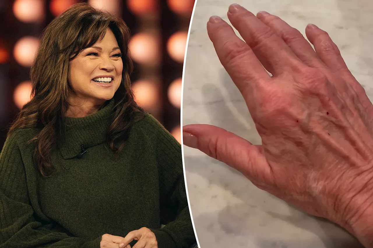 Valerie Bertinelli reveals 'scary' health incident that left her 'weeping uncontrollably'