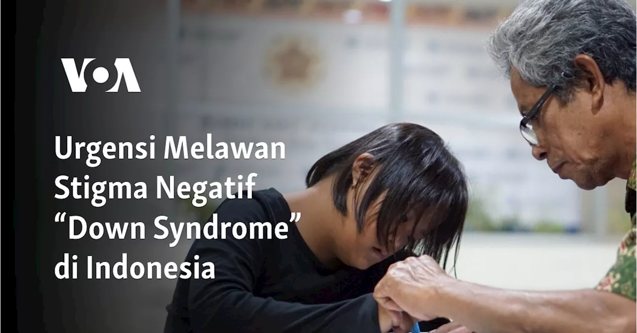 Urgensi Melawan Stigma Negatif “Down Syndrome” di Indonesia