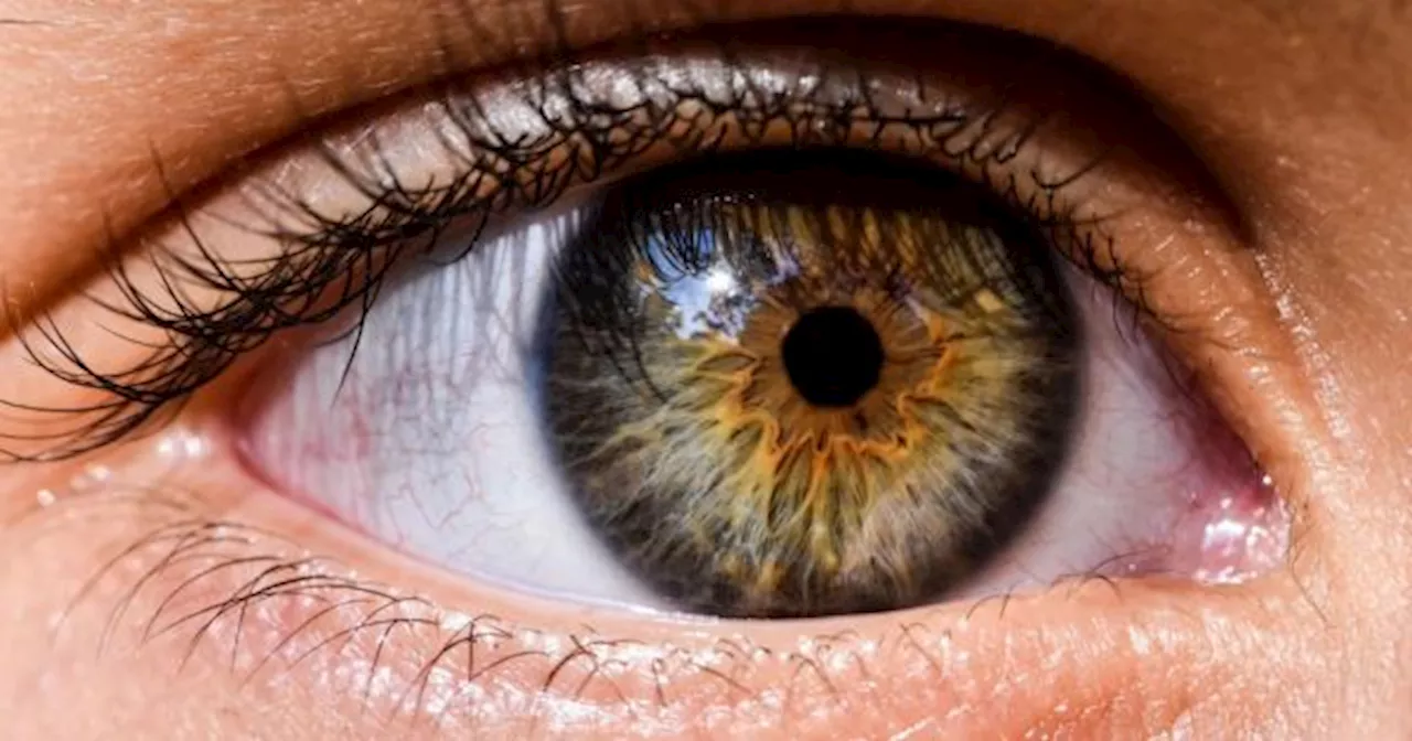 Chau miopía y astigmatismo: el alimento clave que fortalece la vista y evita la pérdida de la visión