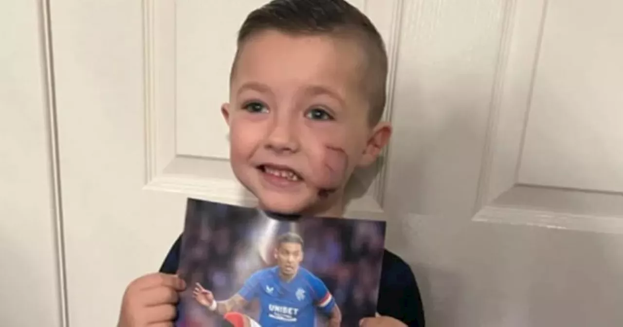 Schoolboy scarred for life in XL Bully attack gets letter from Rangers heroes