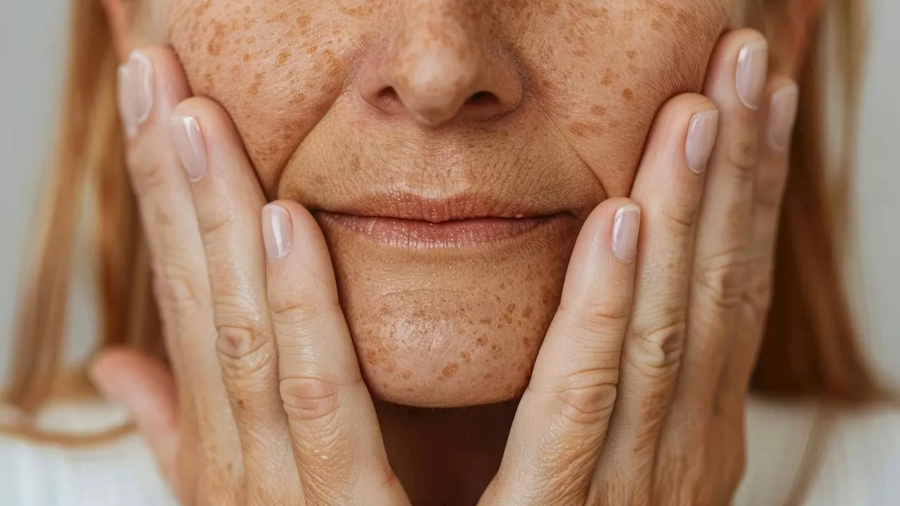 Anti-Aging-Tipp: Pigmentflecken? DAS hilft wirklich!