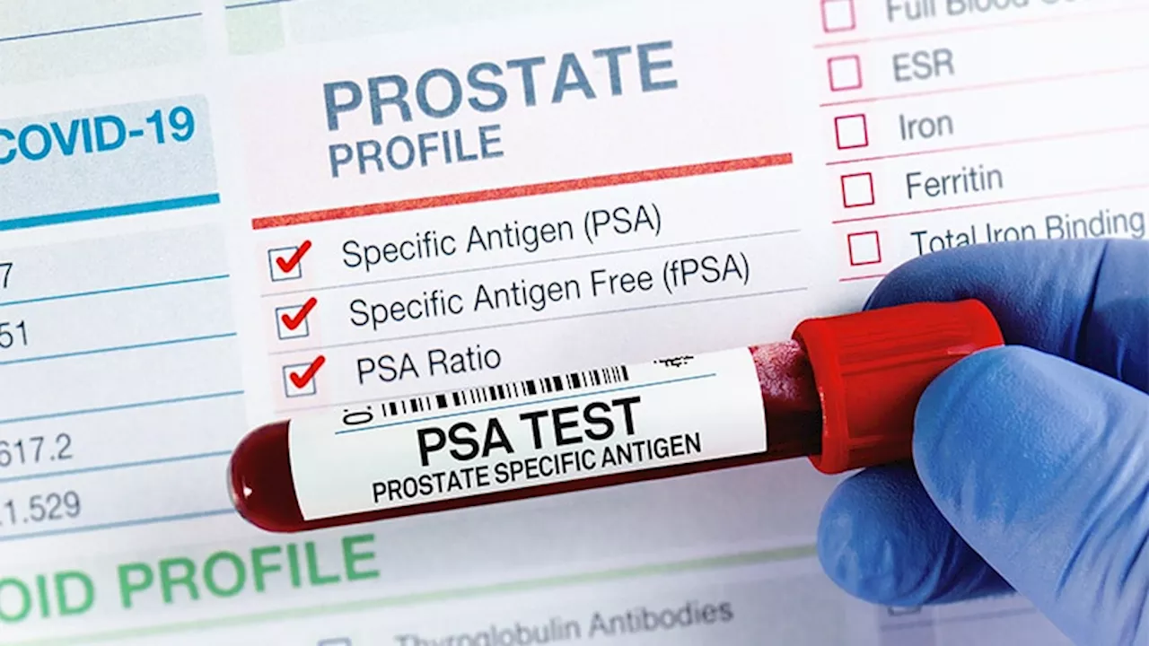 PSA Testing: Which Canadians Have Greater Need?