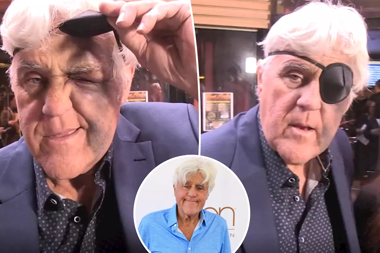 Jay Leno suffers brutal injuries from hitting his head on a rock after 'stupid' mistake