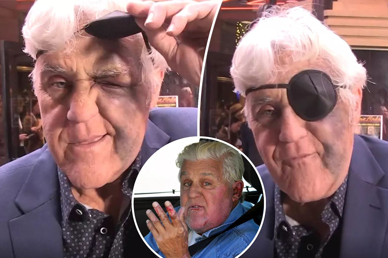 Jay Leno reveals nasty bruise on face after falling down a hill, landing on rock 2 years after body burns