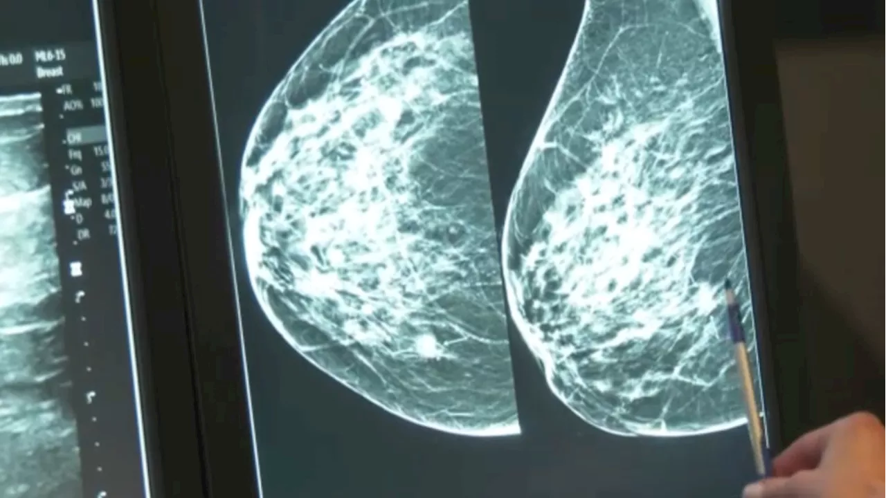 Mobile mammography service coming to Claresholm, Alta.