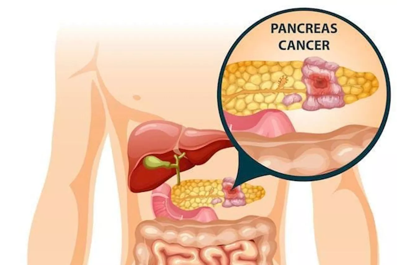 Fungsi dan Cara Menjaga Pankreas, Si Organ Kecil dengan Peran Besar