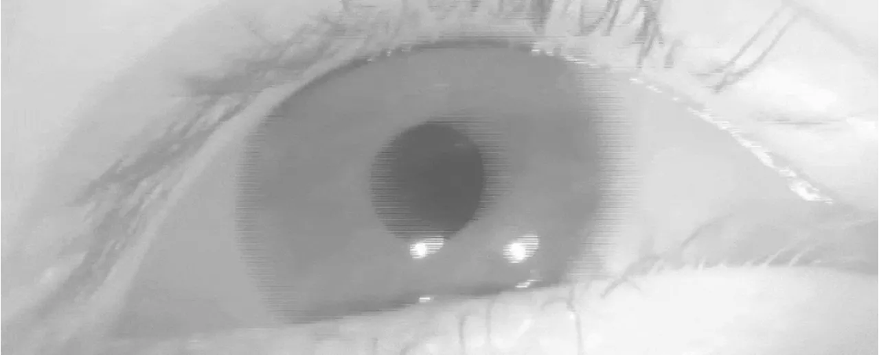 A Small Quirk in Your Eye Movement May Predict Alzheimer's Risk