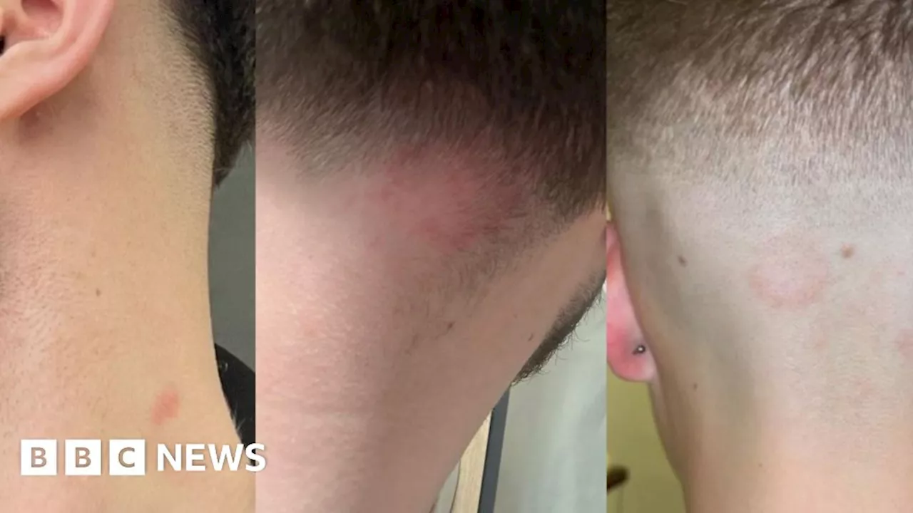 Why did I getting ringworm from my barber?
