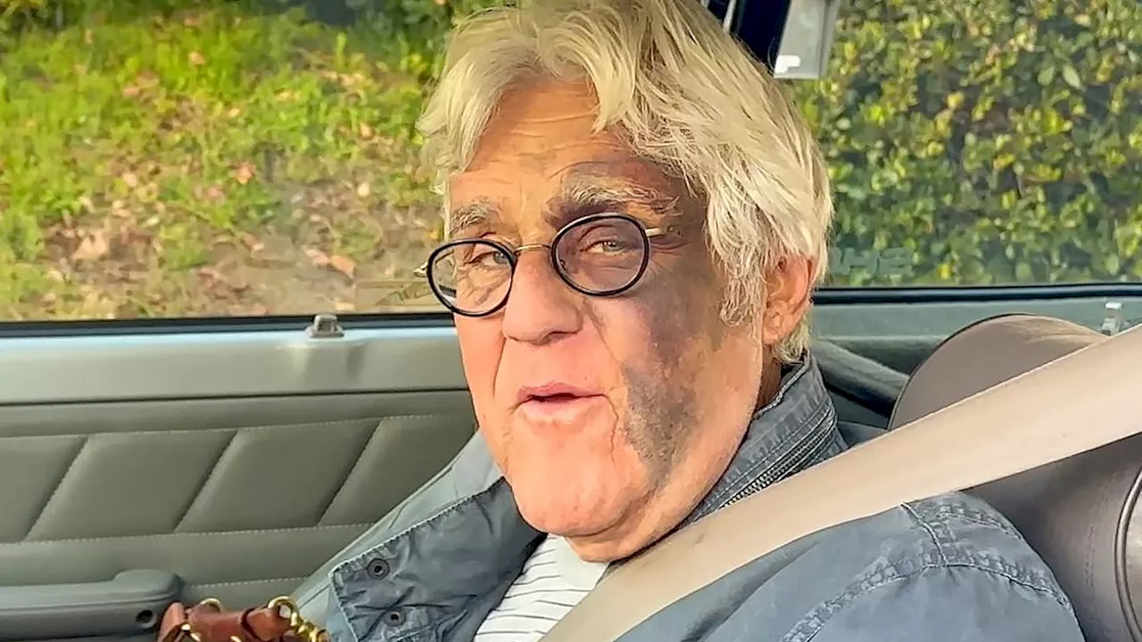 Jay Leno sparks wild gambling debt conspiracy theory as fans question his bruised face