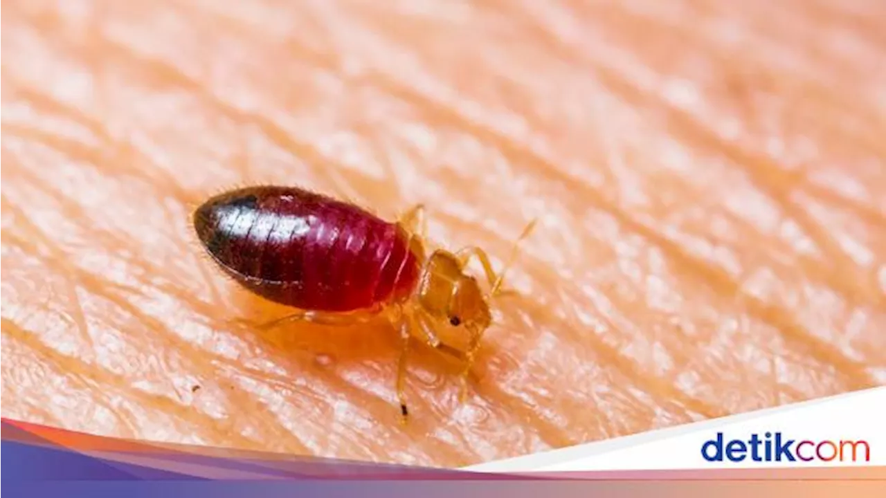 4 Cara Membasmi Kutu Kasur dengan Mudah, Cegah Kulit Gatal-gatal