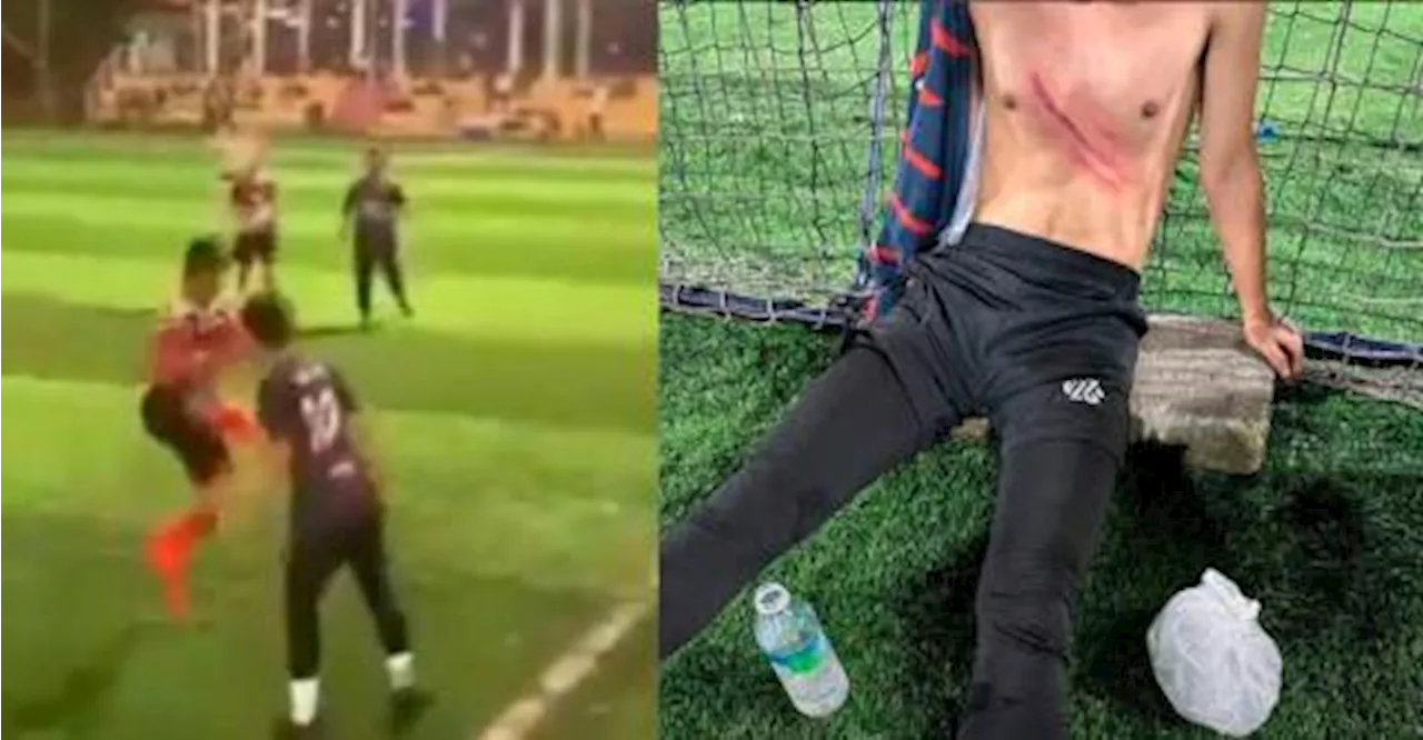 Footballer left with severe scratches after chest kick, offender only gets yellow card