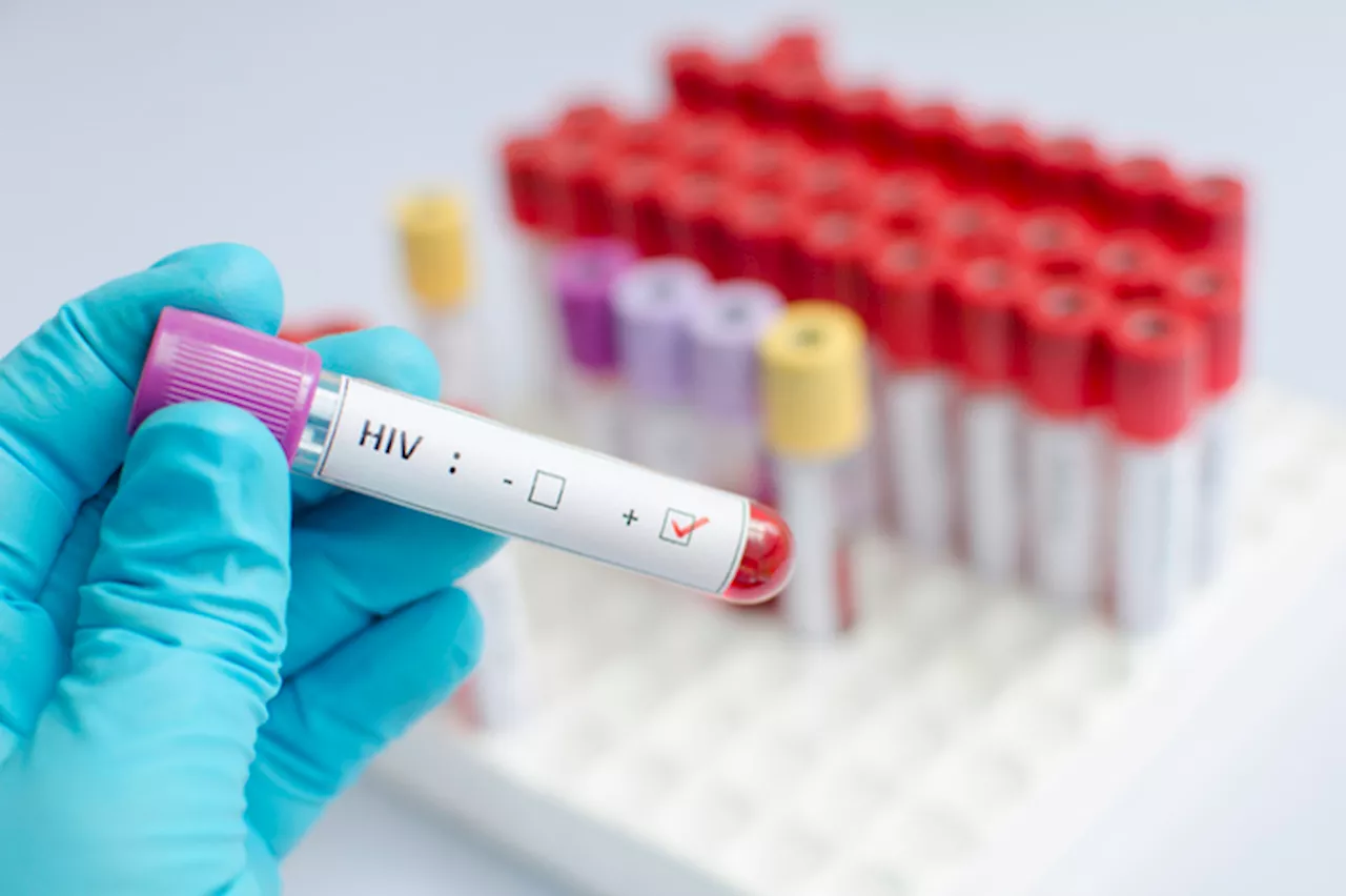 Hiv, crescono le nuove diagnosi in Italia