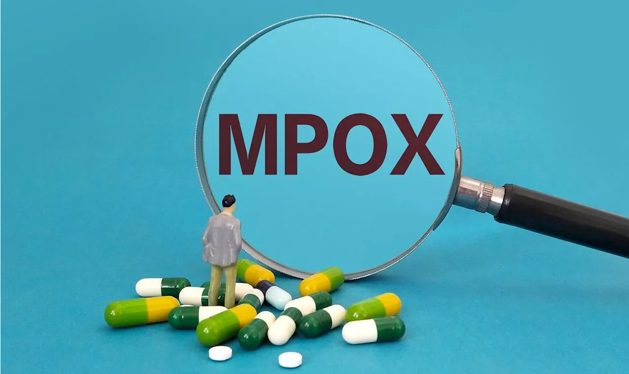 Four new mpox cases logged in Calabarzon —DOH