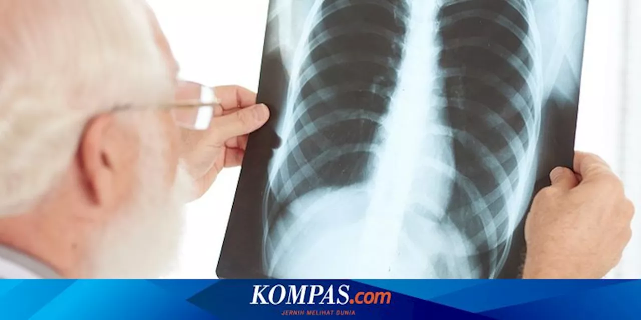 Apa Saja Gejala Tuberkulosis (TBC)?