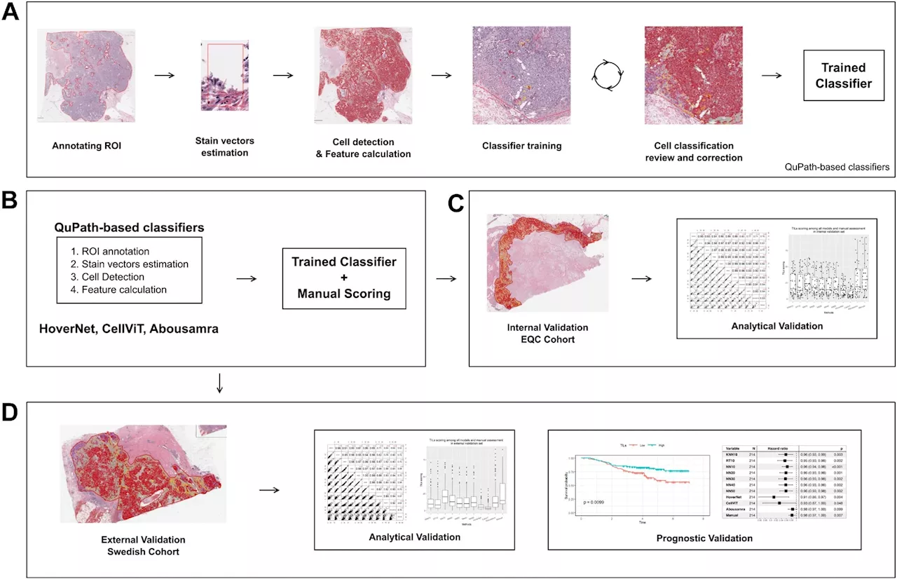 AI models redefine TIL scoring in breast cancer but face challenges in real-world validation