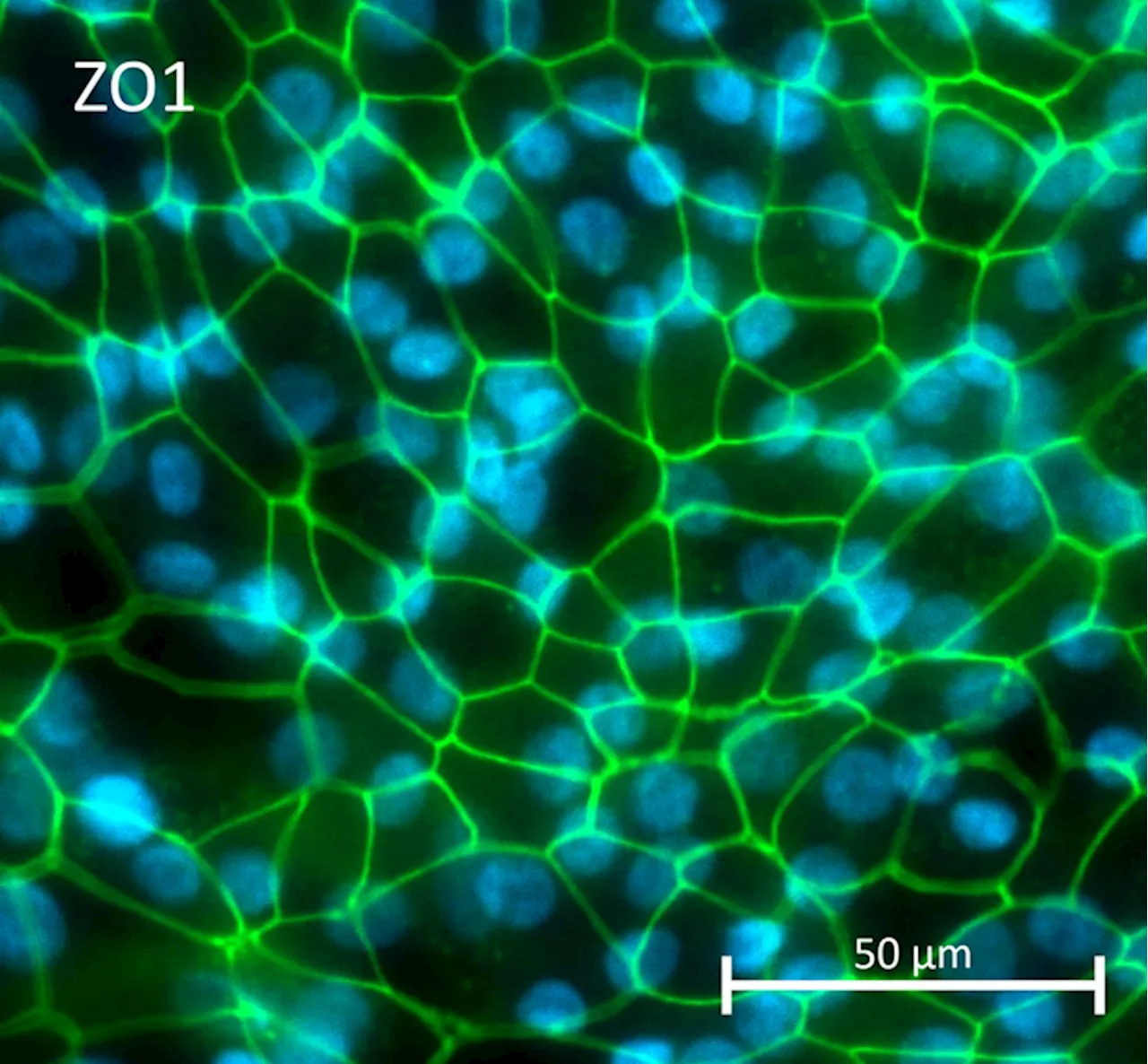 Assessment of gene therapy viral vectors in RPE cells