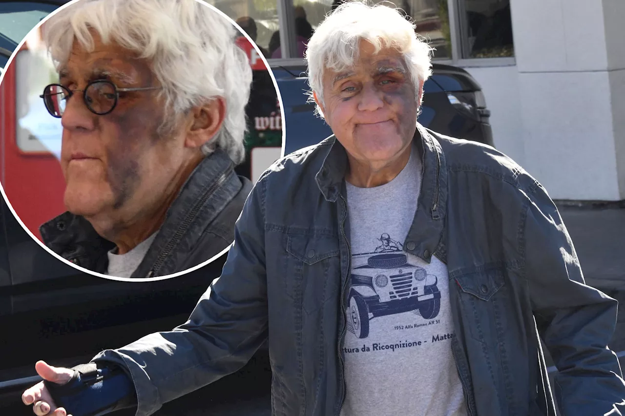 Jay Leno grabs a burger at In-N-Out after brutal fall left him black-eyed and badly bruised