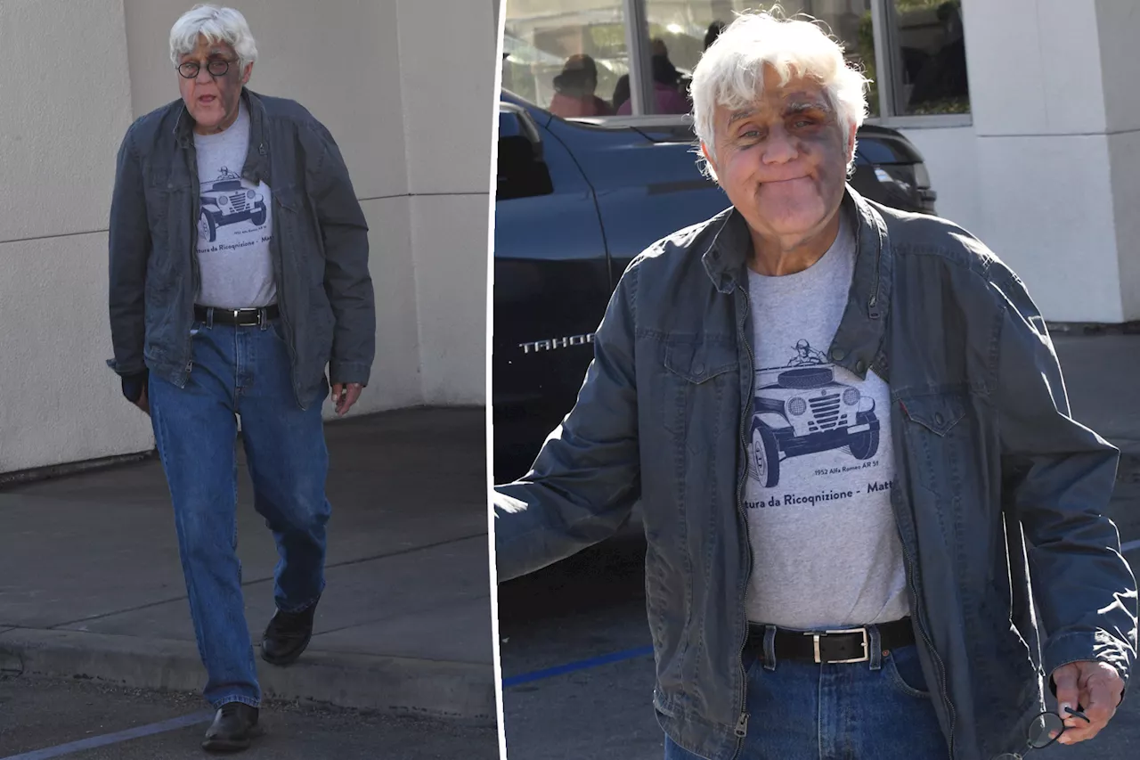 Jay Leno appears in good spirits despite massive nasty bruise from falling down a hill