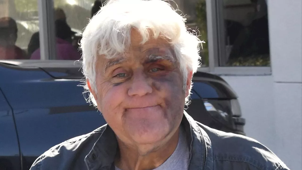 Jay Leno Spotted After Nasty Fall: Bruise and Brace on Display