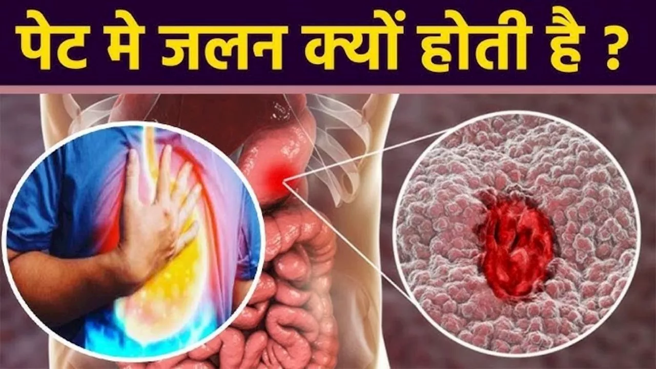 पेट में जलन पड़ती है तो क्या खाना चाहिए? Stomach burning से तुरंत आराम दिलाएंगे ये घरेलू नुस्खे