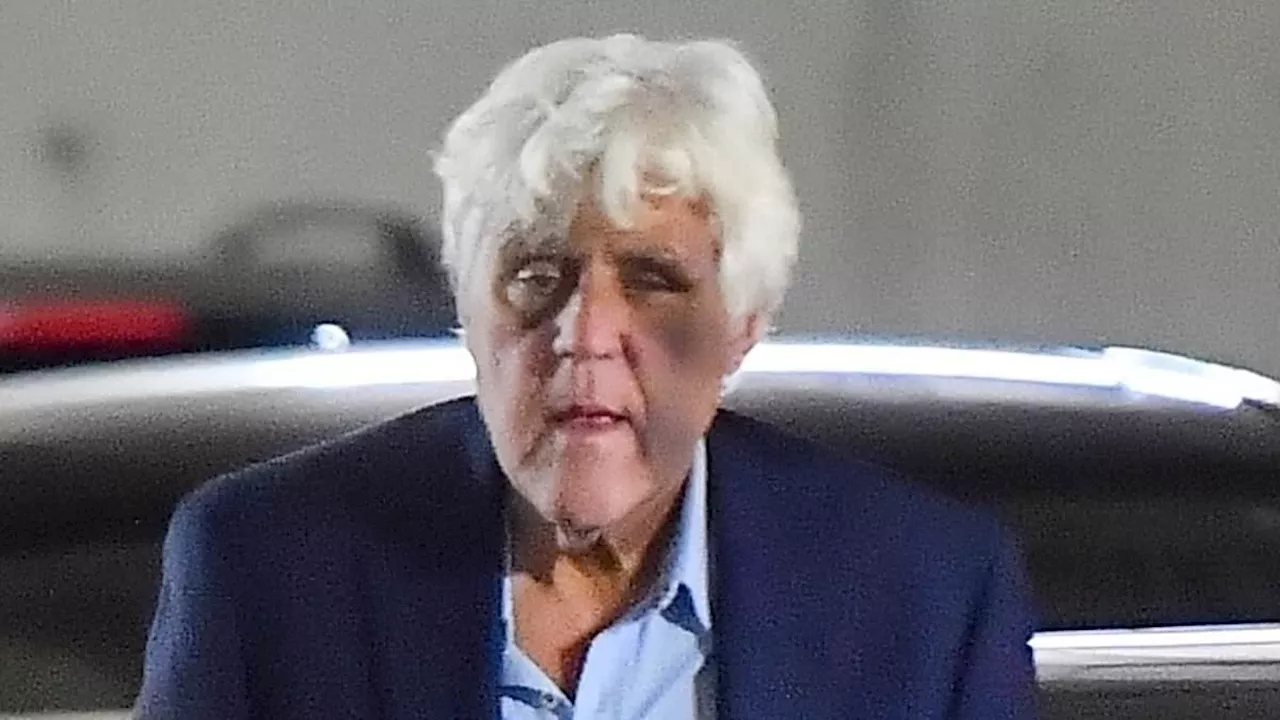 Jay Leno Spotted With Injuries After 60-Foot Fall