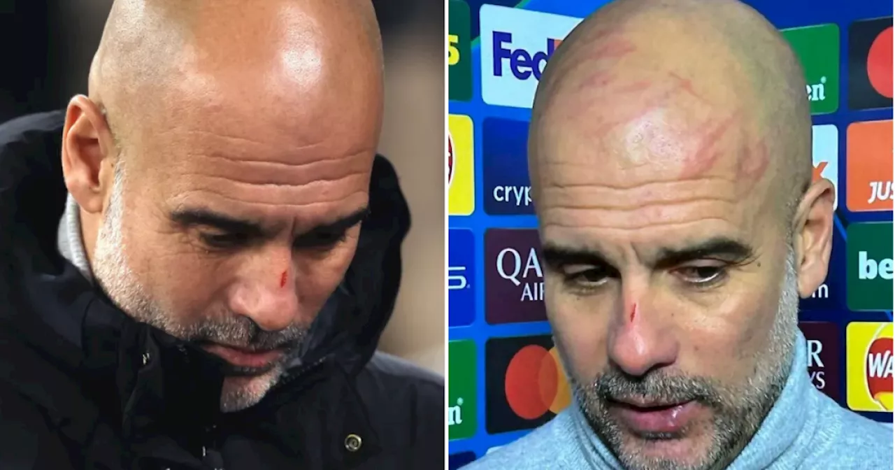 Pep Guardiola explains cut on his nose after Man City draw vs Feyenoord