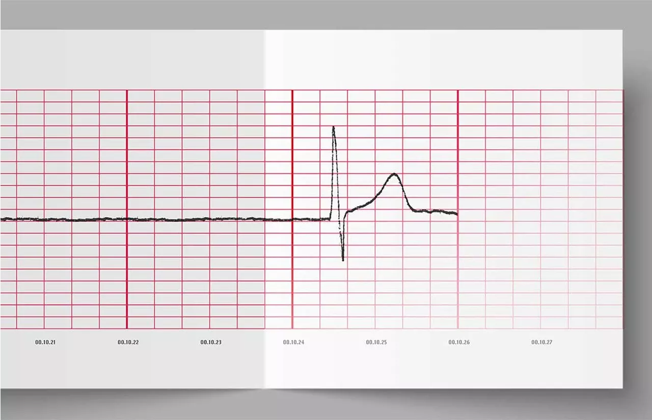 The radical treatments bringing people back from the brink of death