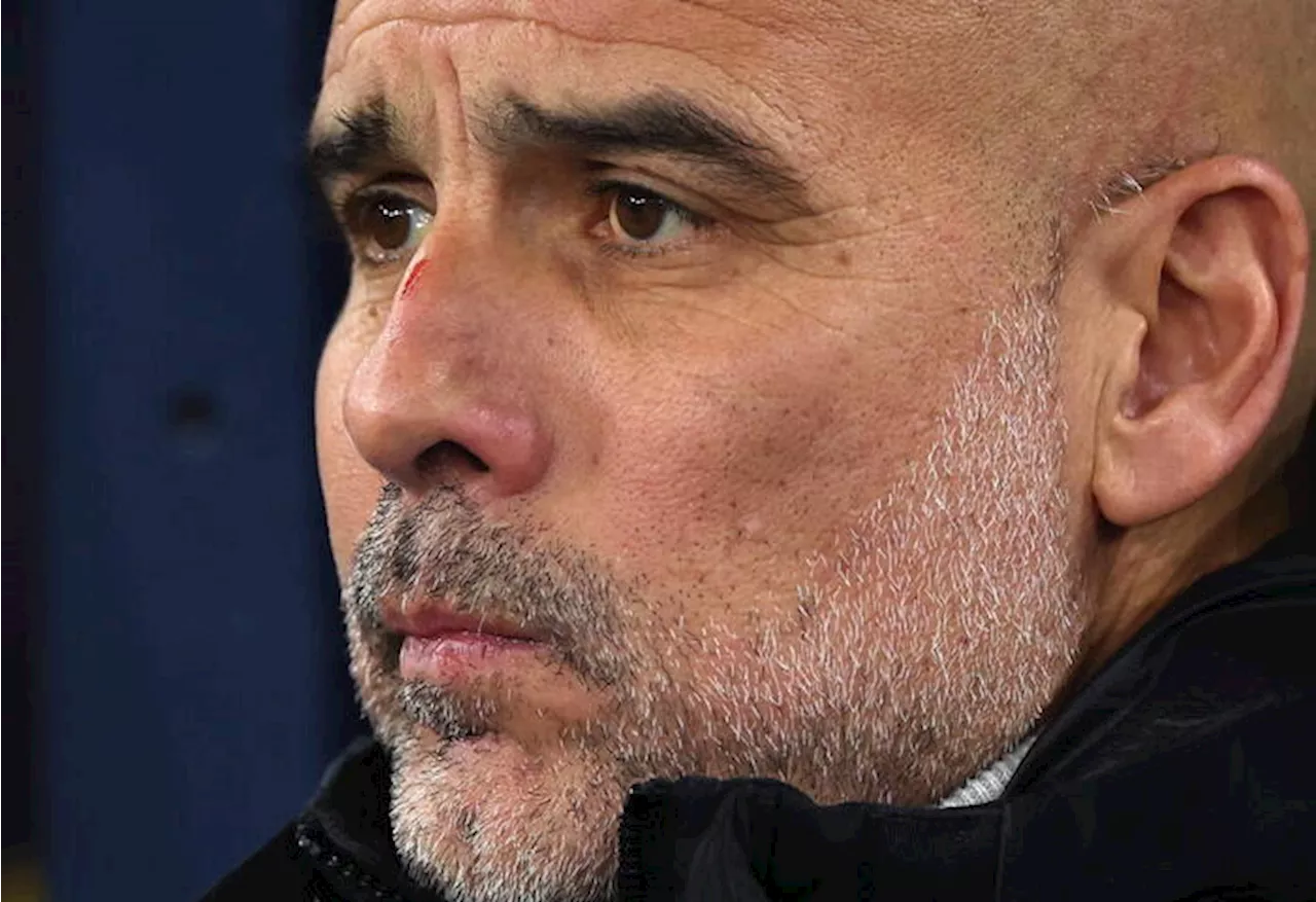 Il City in caduta libera, Guardiola si fa male dai nervi