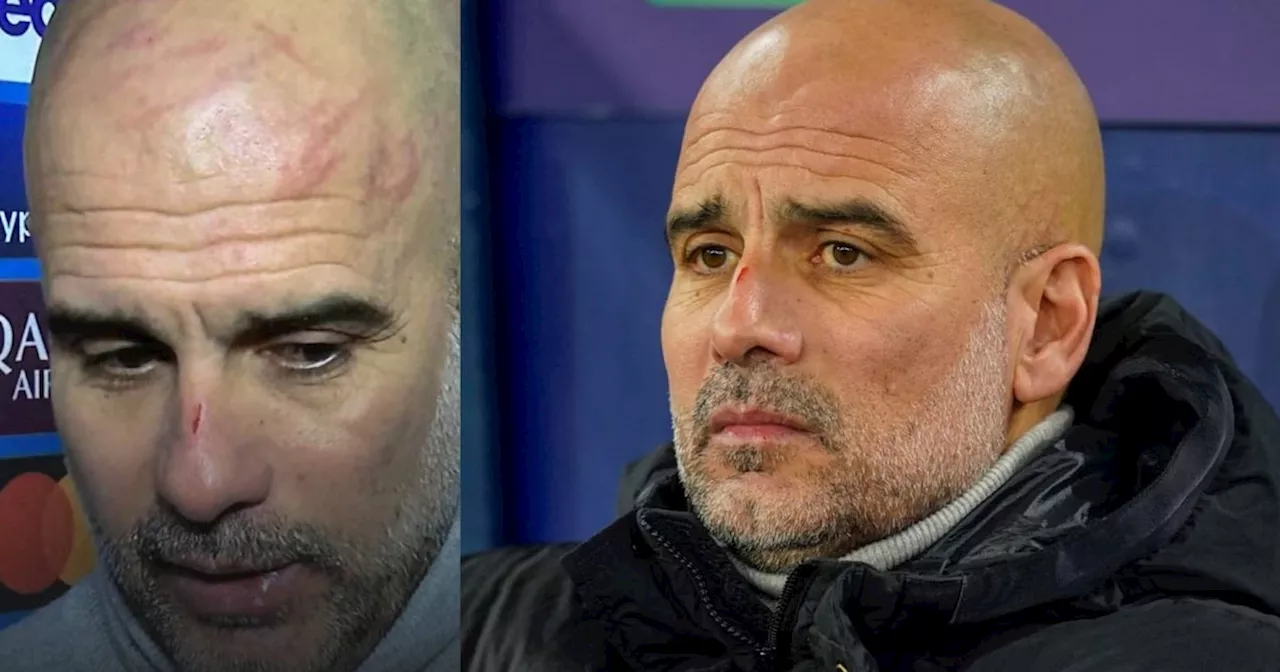 ‘Quiero lastimarme’; Pep Guardiola y sus rasguños tras empate del City ante Feyenoord (VIDEO)