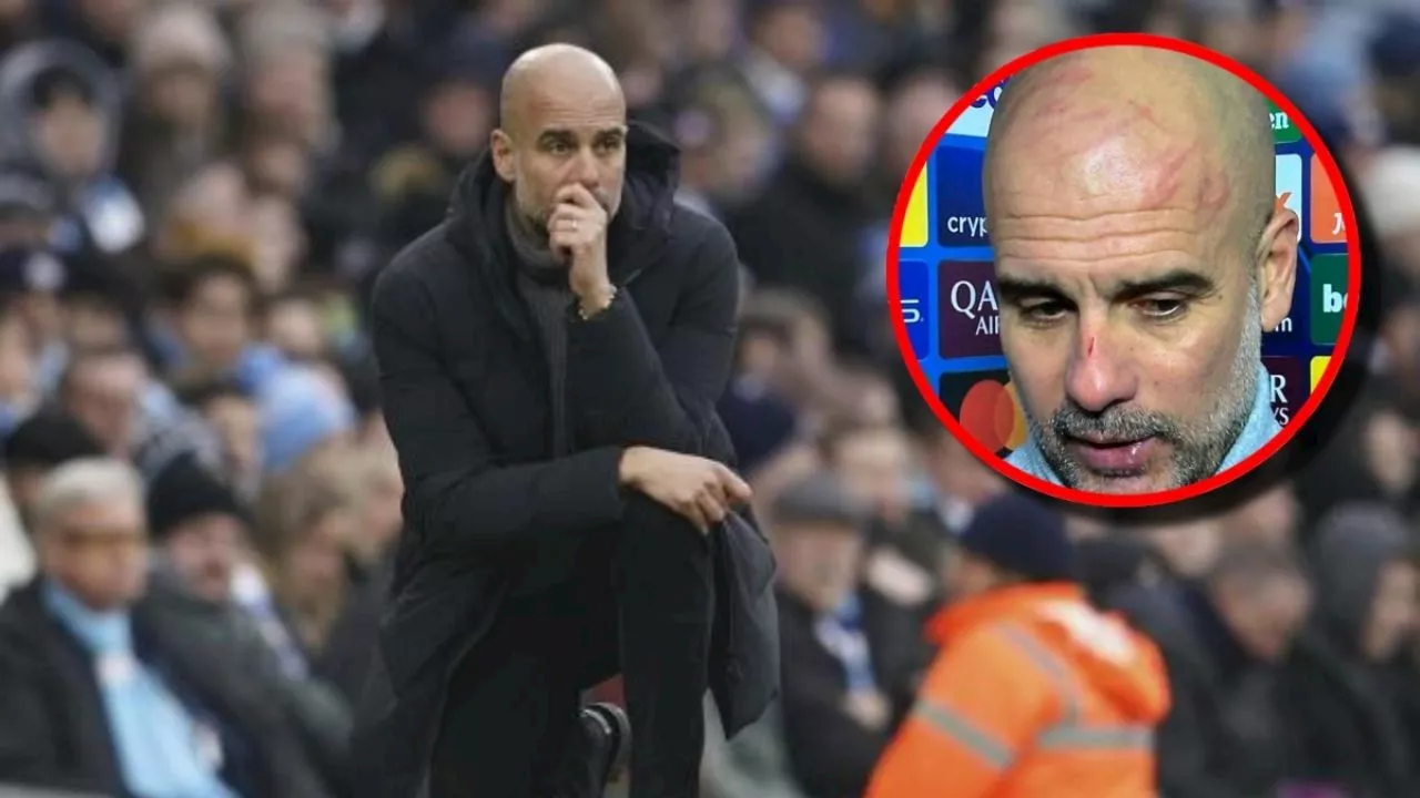 Esta es la razón por la que Pep Guardiola apareció 'golpeado' en la Champions League