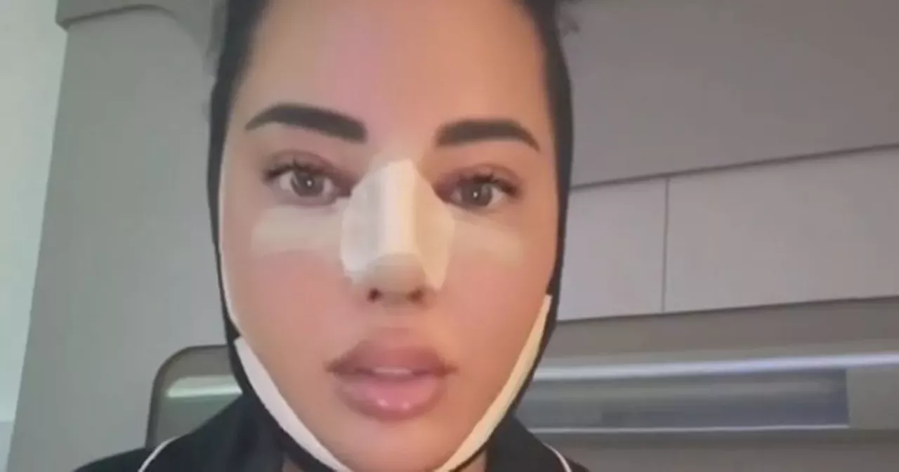 Essex Star Yazmin Oukhellou Shares Her Journey Through Cosmetic Surgery In Turkey