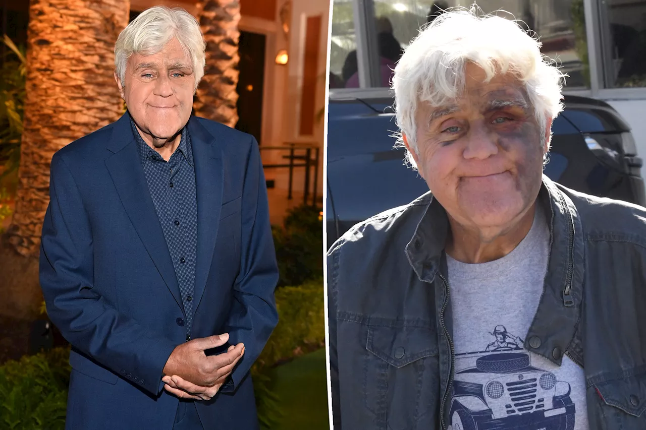  Jay Leno spotted at LA pastrami spot after dramatic fall: 'He's healing well'