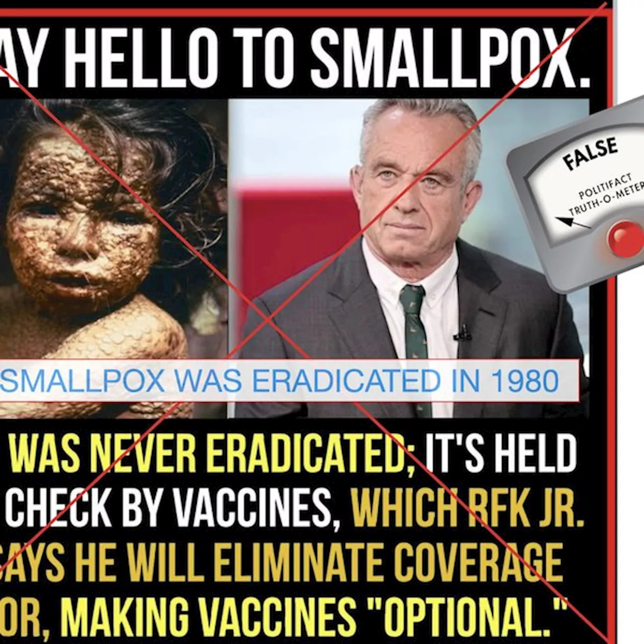 Smallpox was officially eradicated in 1980